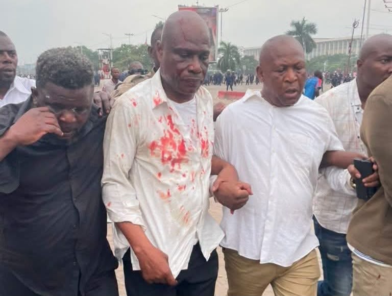Kinshasa : des tensions lors du sit-in de l’opposition ravivent les inquiétudes sur l’exercice des libertés publiques